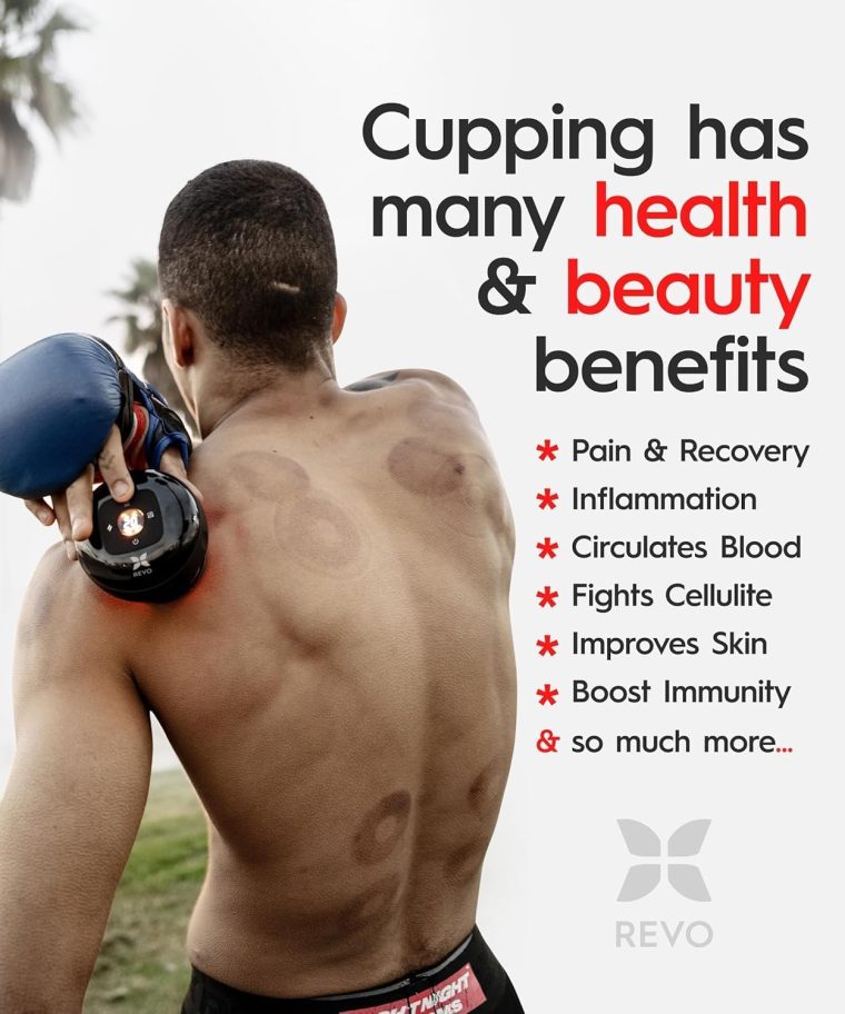 REVO The Original 4-in-1 Smart Cupping Therapy Massager, Red Light Therapy for Targeted Pain Relief, Knots, Aches, Muscle Soreness, Circulation & Tighter Skin, Portable Cupping Kit - Image 4